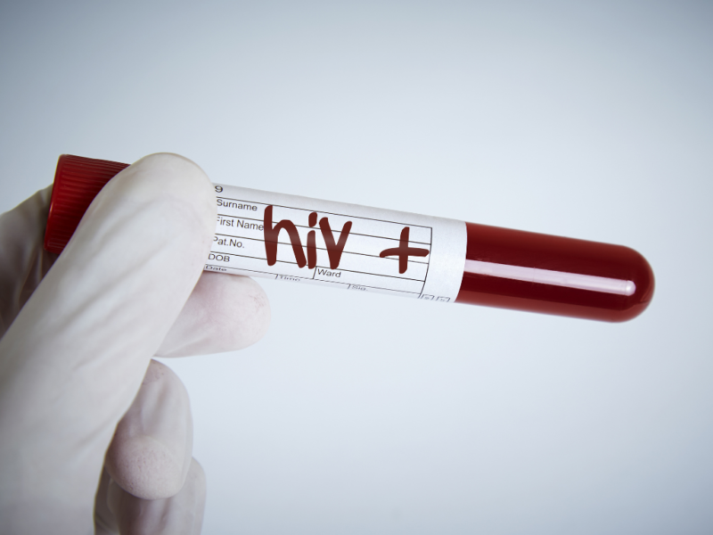 HIV: Importância do Acompanhamento Psicológico
